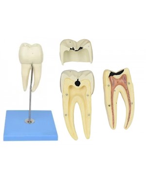 Dente Molar Inferior com Raiz Dupla 