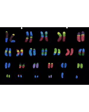 Pares de Cromossomos em Placa  SD-5075