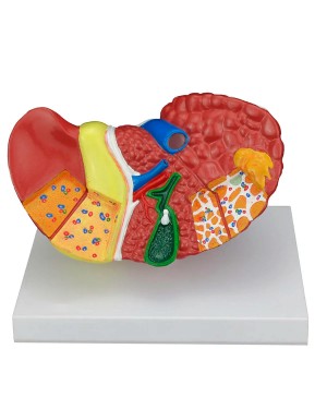 Fígado com Patologia SD-5206