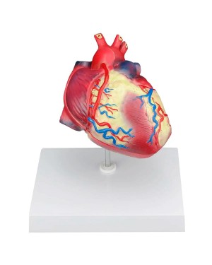 Hipertrofia de coração