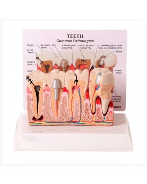 Patologia Dentária e Placa Explicativa SD-5202