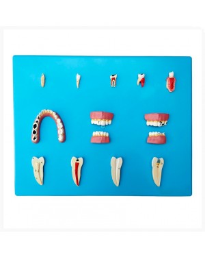 Patologia Dentária com 12 peças  SD-5059/L