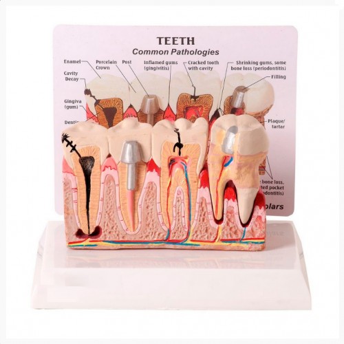 Patologia Dentária e Placa Explicativa SD-5202