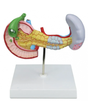 Modelo Patológico do Pâncreas, Baço, Duodeno e Vesícula Biliar  SD-5205 